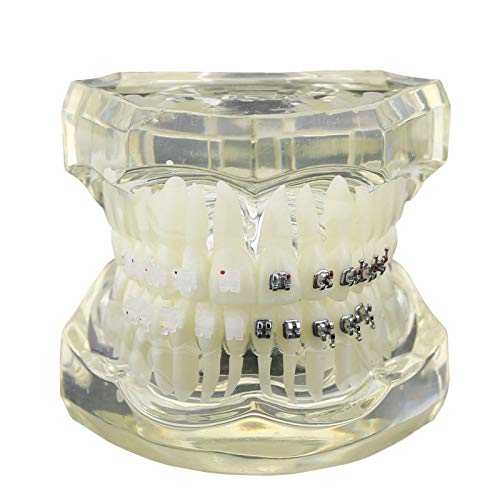 NSKI Diş Ortodonti Çalışma Diş Modeli ile Metal Seramik Parantez M3003 (Temizle)